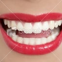 These are not my teeth.  I want very wide separated teeth like this.  I love longer front teeth.