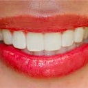 These are not my teeth.  I like teeth that are separated like piano keys. Each one evenly spaced, not on the others. I love longer front teeth. These are still somewhat crowded to me. I prefer next photo.