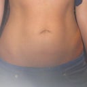 After 6 Weeks