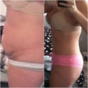 Before and after