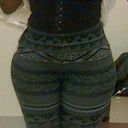 uneven hips