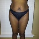 Before Front