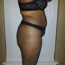 Before Side