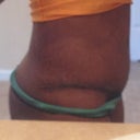 this is my left side @ 3wks