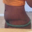 right side 3wks
