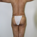 pre op back