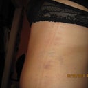 swollen but flat