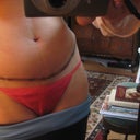2011 - 2 weeks today!! Front view - love the belly button!  Can you see the lump on the right side?  Dog ear?