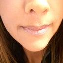 2012 - Six years after Lip Lift. Here is what my scar looks like close up...six years after the procedure.