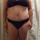 Front (8 weeks post)