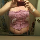 the day after surgery. I will take a picture without the compression garment on when i am cleared for showering...