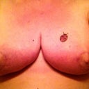 Week 5 Post Op