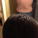 The night before surgery: Back