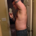 The night before surgery: Side