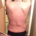 Day 2: Back view