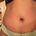 5 Mos PO.. still not flat. my BB has a good shape. Too many stretch marks too that are more obvious than I was hoping them to be.