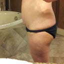 Day before smart/vibro lipo