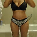Will be 4 weeks post op on Wenesday.