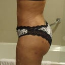 Will be 4 weeks post op on Wenesday.
