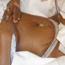Just Dr. J taken a look. He took off 7 pounds.