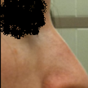 Profile before