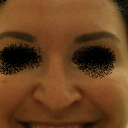 Before - you can see how my nose droops and changes shape when smiling