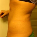 post touch-up side view