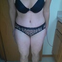 9 Days PO, and swollen!
