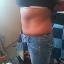 Before tummy tuck
side view :(