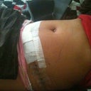 2 days after TT