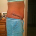 Two weeks side view