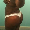6 weeks post op - Back view.  Lots of swelling in lower back.  Butt is still hard.  Can't wait for i to finish "POP" out! LOL