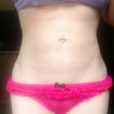 Lumpy tummy.. For now!