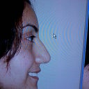 Before- Here you can tell how big my nose was and how the tip dropped, yuck