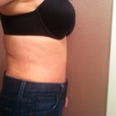 8 1/2 weeks post op side view