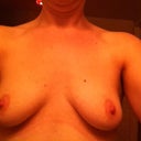 before surgery