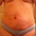 Frontal view of the yucky tummy