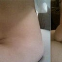 Oh dear goodness. I had never seen how I look from this angle before. Wow. OK, tomorrow morning it is sayonara to that hanging flop of skin and fat down there. Wow.