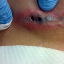 The holes look like a pig snout!