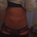 9 day post op