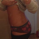 9 day post op