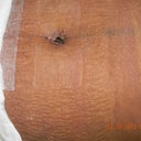 2weeks belly button does not hurt