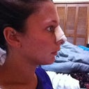 Day 3, Side profile.