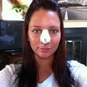 Saturday, day 4 post op.