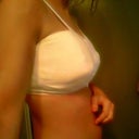 2 Days post-op; (A LOT of gauze is causing the pointy ness!)
