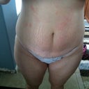 Before Pic #5 3/23/2012