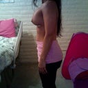 2 weeks post op Side
