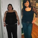the day after surgery 03/2009 through pre pregnancy 01/2012
