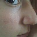 side view. ;(