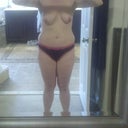 Front view two weeks before surgery - YUCK!!